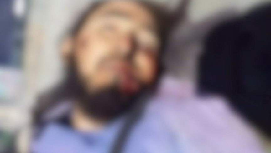 نبردی در هرات یک کشته و دو زخمی از طالبان گرفت