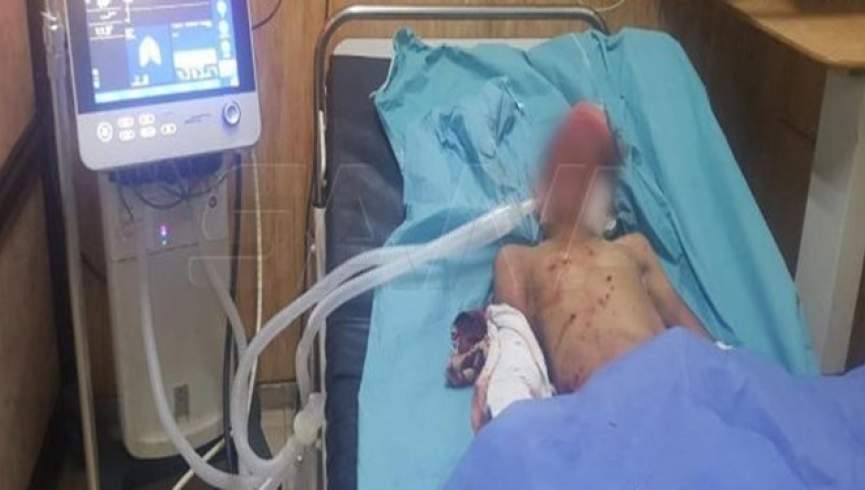 بر اثر انفجار ماین در دیرالزور سوریه 3 کودک شهید و زخمی شدند