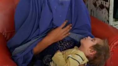 در سال جاری میلادی 3.5 میلیون کودک افغانستانی به سؤتغذیه مبتلا خواهند شد