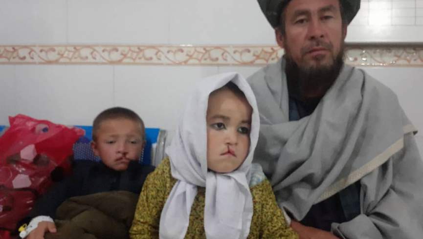 د سعادت موسسه په تخار کې د ۲۰۰ ماشومانو د شکېدولو شونډو درملنه کوي