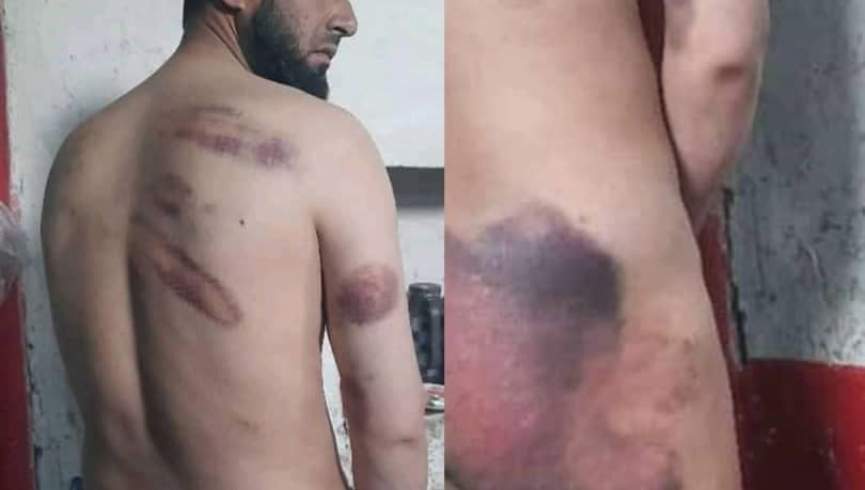 یک سرباز حکومت پیشین در بدخشان زیر شکنجه طالبان کشته شد